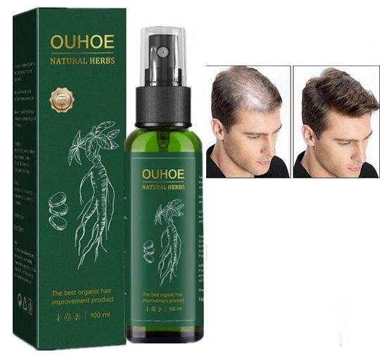 OUHOE - Spray para el crecimiento capilar
